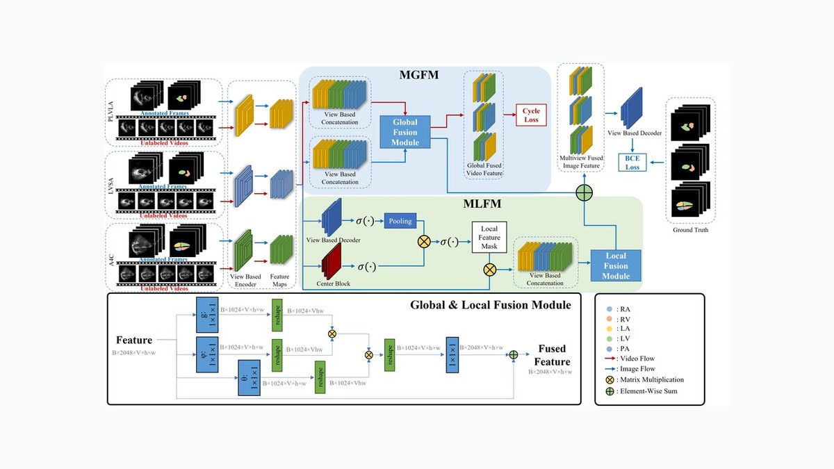 GL-Fusion: Global-Local Fusion Network for Multi-view Echocardiogram Video Segmentation